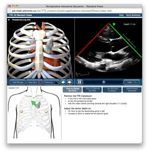 screen capture of Virtual TTE Standard Views module